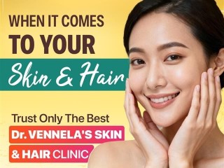 best-skin-specialist-in-peerzadiguda-hair-loss-treatment-in-peerzadiguda