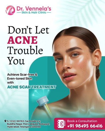 best-skin-specialist-in-peerzadiguda-hair-loss-treatment-in-peerzadiguda-big-1