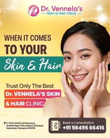 best-skin-specialist-in-peerzadiguda-hair-loss-treatment-in-peerzadiguda-big-0