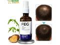 feg-plus-hair-growth-spray-in-pakistan-natural-solution-for-hair-fall-and-hair-regrowth-small-0