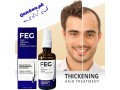 feg-plus-hair-growth-spray-in-pakistan-ultimate-solution-for-hair-regrowth-03001819306-small-0