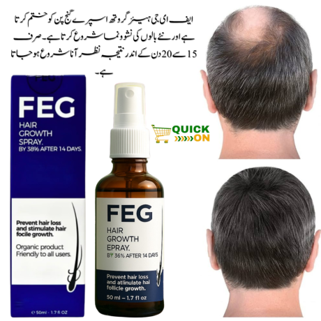 feg-plus-hair-growth-spray-the-secret-to-naturally-thicker-hair-03001819306-big-0