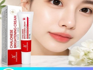 chalonese-brightening-in-pakistan-0328-4716038
